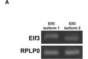 Image no. 2 for anti-E74-Like Factor 3 (Ets Domain Transcription Factor, Epithelial-Specific) (ELF3) antibody (ABIN6140124)