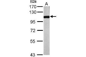 Image no. 1 for anti-Aminopeptidase Puromycin Sensitive (NPEPPS) (Internal Region) antibody (ABIN2856994)