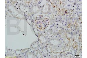 Image no. 1 for anti-Alkaline Phosphatase, Liver/bone/kidney (ALPL) (AA 52-150) antibody (ABIN730988)