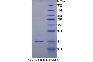 Image no. 2 for Serum Amyloid A (SAA) ELISA Kit (ABIN6574095)