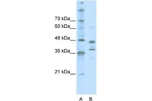 Image no. 1 for anti-SWI/SNF Related, Matrix Associated, Actin Dependent Regulator of Chromatin, Subfamily B, Member 1 (SMARCB1) (Middle Region) antibody (ABIN2778302)