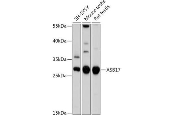 ASB17 抗体  (AA 30-130)