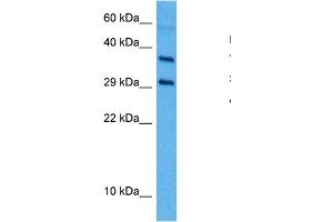 Image no. 7 for anti-Transforming Growth Factor, beta 1 (TGFB1) (Middle Region) antibody (ABIN2780306)