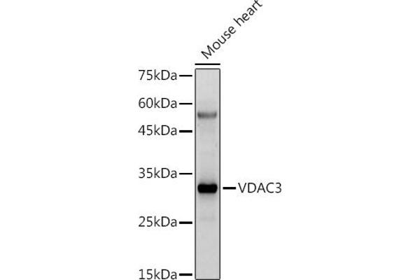 VDAC3 anticorps  (AA 1-283)