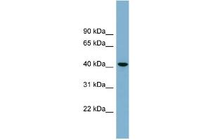 Image no. 1 for anti-UDP-Gal:betaGlcNAc beta 1,4- Galactosyltransferase, Polypeptide 2 (B4GALT2) (Middle Region) antibody (ABIN2781897)