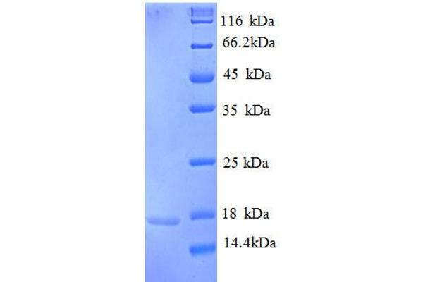 Replication Protein A3, 14kDa (RPA3) (AA 1-119), (partial) protein (His tag)