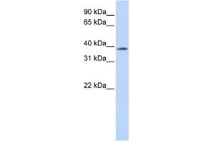 Image no. 1 for anti-Methyl-CpG Binding Domain Protein 2 (MBD2) (N-Term) antibody (ABIN2779675)