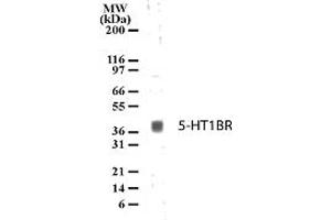 Image no. 1 for anti-Serotonin Receptor 1B (HTR1B) (AA 8-26) antibody (ABIN208265)