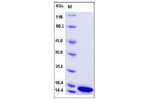Image no. 1 for Histone H2B Type 2-E (HIST2H2BE) (AA 1-126) protein (ABIN2004239)
