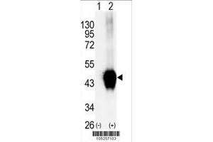 Image no. 2 for anti-Branched Chain Ketoacid Dehydrogenase Kinase (BCKDK) (AA 325-356), (C-Term) antibody (ABIN391130)