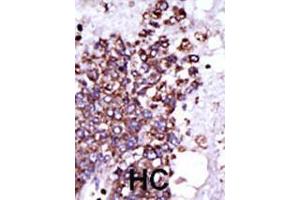 Image no. 1 for anti-Calcium/calmodulin-Dependent Protein Kinase I (CAMK1) (AA 341-370), (C-Term) antibody (ABIN391310)