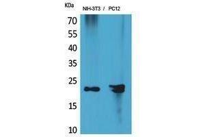 Image no. 1 for anti-Hepatoma-Derived Growth Factor-Related Protein 3 (HDGFRP3) (Internal Region) antibody (ABIN3187976)