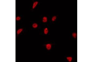 Image no. 1 for anti-HMG Box-Containing Protein 1 (HBP1) (pSer402) antibody (ABIN6255308)
