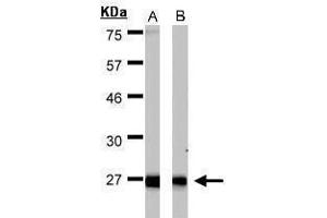 Image no. 4 for anti-Hydroxysteroid (17-Beta) Dehydrogenase 10 (HSD17B10) (C-Term) antibody (ABIN2854703)