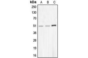 Western blot analysis of CHRNA10 expression in MDAMB453 (A), NCIH292 (B), COLO205 (C) whole cell lysates.