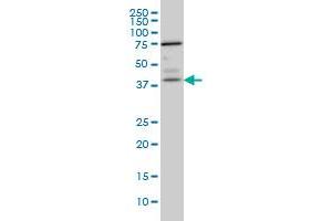 Image no. 2 for anti-Paraneoplastic Antigen MA1 (PNMA1) (AA 62-160) antibody (ABIN563990)