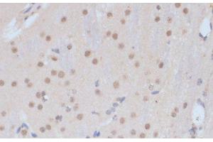 Immunohistochemistry of paraffin-embedded Mouse brain using CDK9 Polyclonal Antibody at dilution of 1:100 (40x lens).
