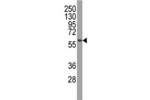 Image no. 3 for anti-PTEN Induced Putative Kinase 1 (PINK1) antibody (ABIN3032404)