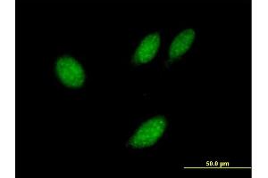 Image no. 2 for anti-Thioredoxin-Like 4B (TXNL4B) (AA 1-149) antibody (ABIN527274)