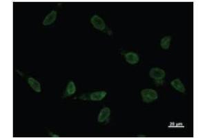 Image no. 1 for anti-Ventral Anterior Homeobox 2 (VAX2) antibody (ABIN932999)