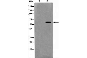 Image no. 2 for anti-MutY Homolog (E. Coli) (MUTYH) antibody (ABIN6263442)