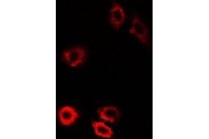 Image no. 1 for anti-Piwi-Like 1 (PIWIL1) antibody (ABIN2966714)