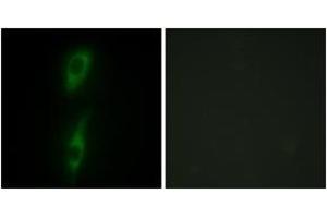 Image no. 3 for anti-Activin A Receptor Type II-Like 1 (ACVRL1) (AA 196-245) antibody (ABIN1533718)