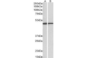 Image no. 1 for anti-Acetyl-CoA Acetyltransferase 1 (ACAT1) (AA 253-266) antibody (ABIN571083)