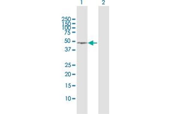 anti-NSFL1 (p97) Cofactor (p47) (NSFL1C) (AA 1-370) antibody