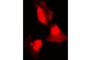Image no. 1 for anti-serum/glucocorticoid Regulated Kinase 1 (SGK1) (Center) antibody (ABIN2707036)