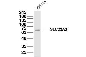 anti-Solute Carrier Family 23 Member 3 (SLC23A3) (AA 201-300) antibody