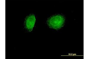 Image no. 1 for anti-Sorting Nexin 1 (SNX1) (AA 1-522) antibody (ABIN520358)
