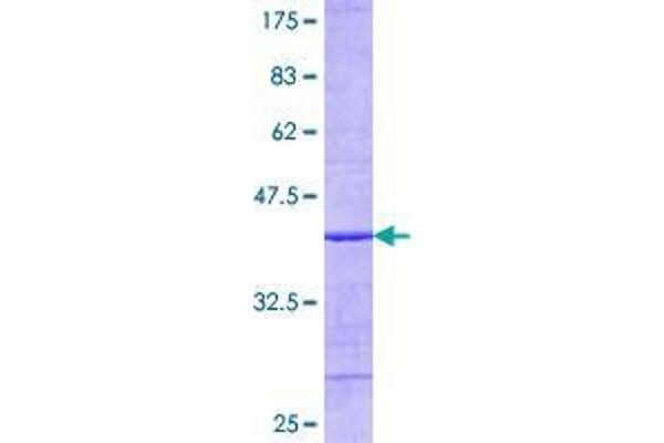 UBE2C Proteins