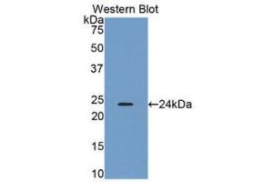 Image no. 1 for anti-Orosomucoid 2 (ORM2) (AA 19-201) antibody (ABIN1078413)