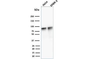 Image no. 4 for anti-Junction Plakoglobin (JUP) antibody (ABIN6939839)