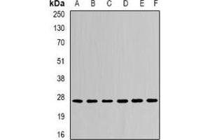 Image no. 2 for anti-Ubiquitin-Conjugating Enzyme E2R 2 (UBE2R2) antibody (ABIN3197585)