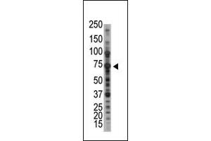 Image no. 1 for anti-Protein Inhibitor of Activated STAT, 1 (PIAS1) (N-Term) antibody (ABIN2495457)