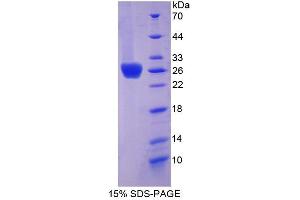 Image no. 1 for Coxsackie Virus and Adenovirus Receptor (CXADR) (AA 20-229) protein (S tag,His tag) (ABIN6237585)