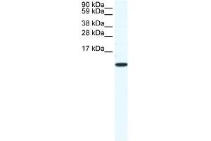 Image no. 1 for anti-Chemokine (C-C Motif) Ligand 5 (CCL5) (Middle Region) antibody (ABIN925838)