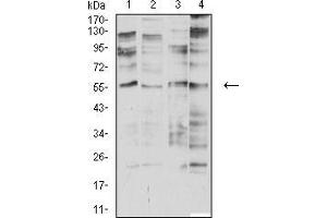 Image no. 1 for anti-Cholinergic Receptor, Nicotinic, alpha 2 (Neuronal) (CHRNA2) (AA 27-264) antibody (ABIN5611312)
