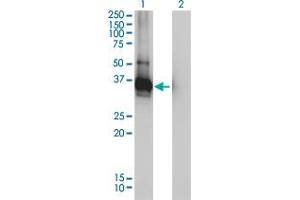 Image no. 2 for anti-Low Density Lipoprotein Receptor Adaptor Protein 1 (LDLRAP1) (AA 1-263) antibody (ABIN565226)