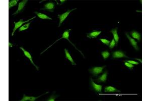 Image no. 2 for anti-ELAV (Embryonic Lethal, Abnormal Vision, Drosophila)-Like 4 (Hu Antigen D) (ELAVL4) (AA 1-366) antibody (ABIN515243)