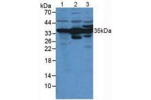 Image no. 3 for Annexin A4 (ANXA4) ELISA Kit (ABIN6720590)