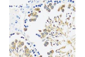 Immunohistochemistry of paraffin-embedded Mouse testis using CALM3 Polyclonal Antibody at dilution of 1:100 (40x lens).