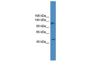 anti-Adenylate Cyclase 2 (Brain) (ADCY2) (Middle Region) antibody