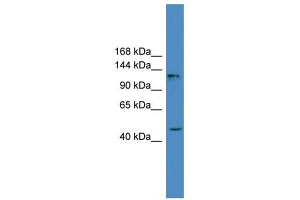 anti-Adenylate Cyclase 2 (Brain) (ADCY2) (Middle Region) antibody