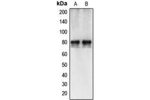 anti-Calpain 12 (CAPN12) (Center) antibody