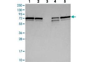 Sorting Nexin 2 anticorps