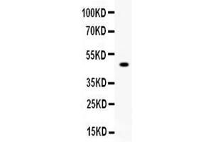 Image no. 1 for anti-Carboxypeptidase B2 (Plasma) (CPB2) (AA 165-387) antibody (ABIN4886546)
