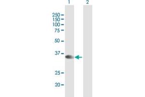 Image no. 1 for anti-Syntaxin 16 (STX16) (AA 1-304) antibody (ABIN948720)